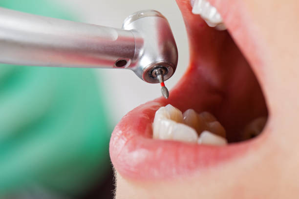 Best Walk-In Emergency Dentist in Woodbridge, CA